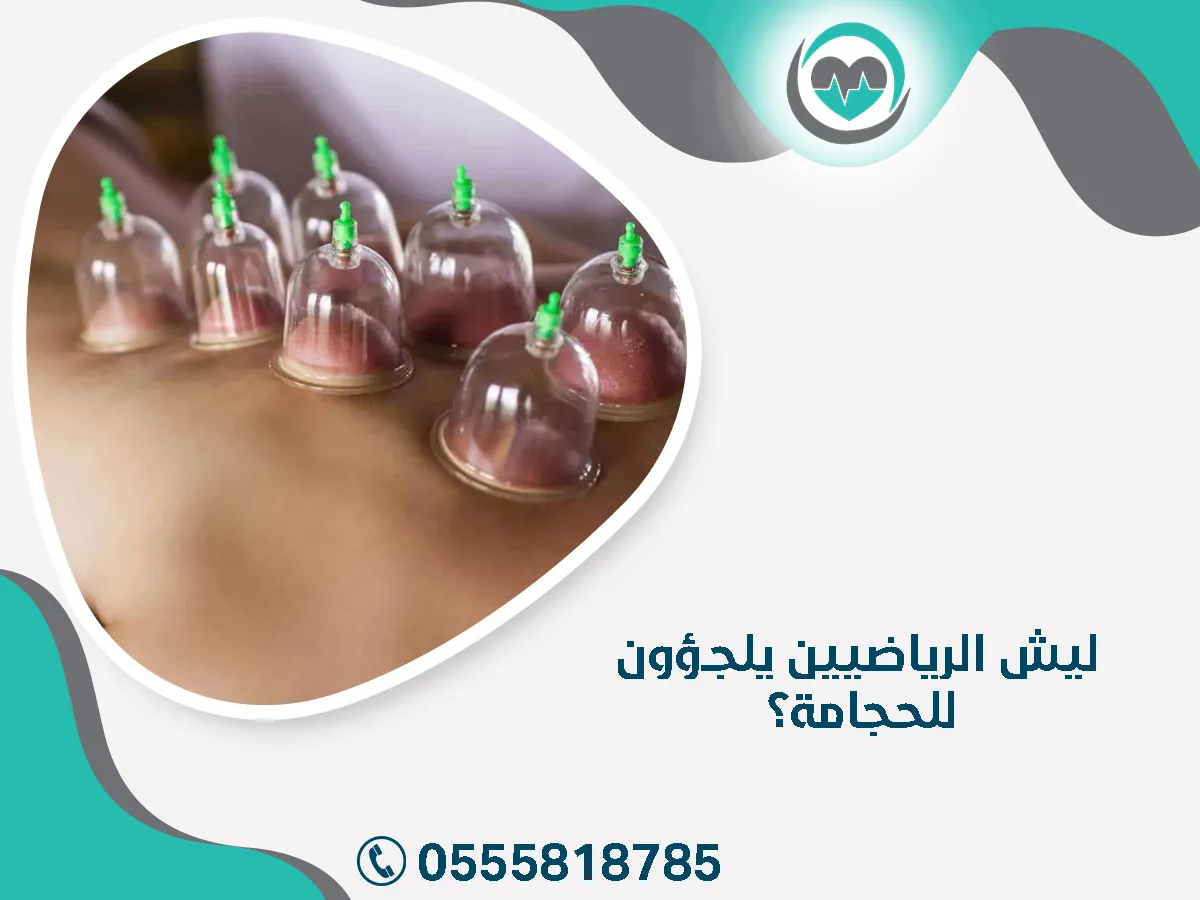 الرياضيين يلجؤون للحجامة