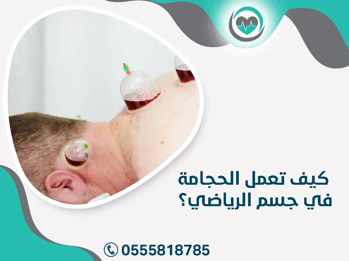 كيف تعمل الحجامة في الجسم 