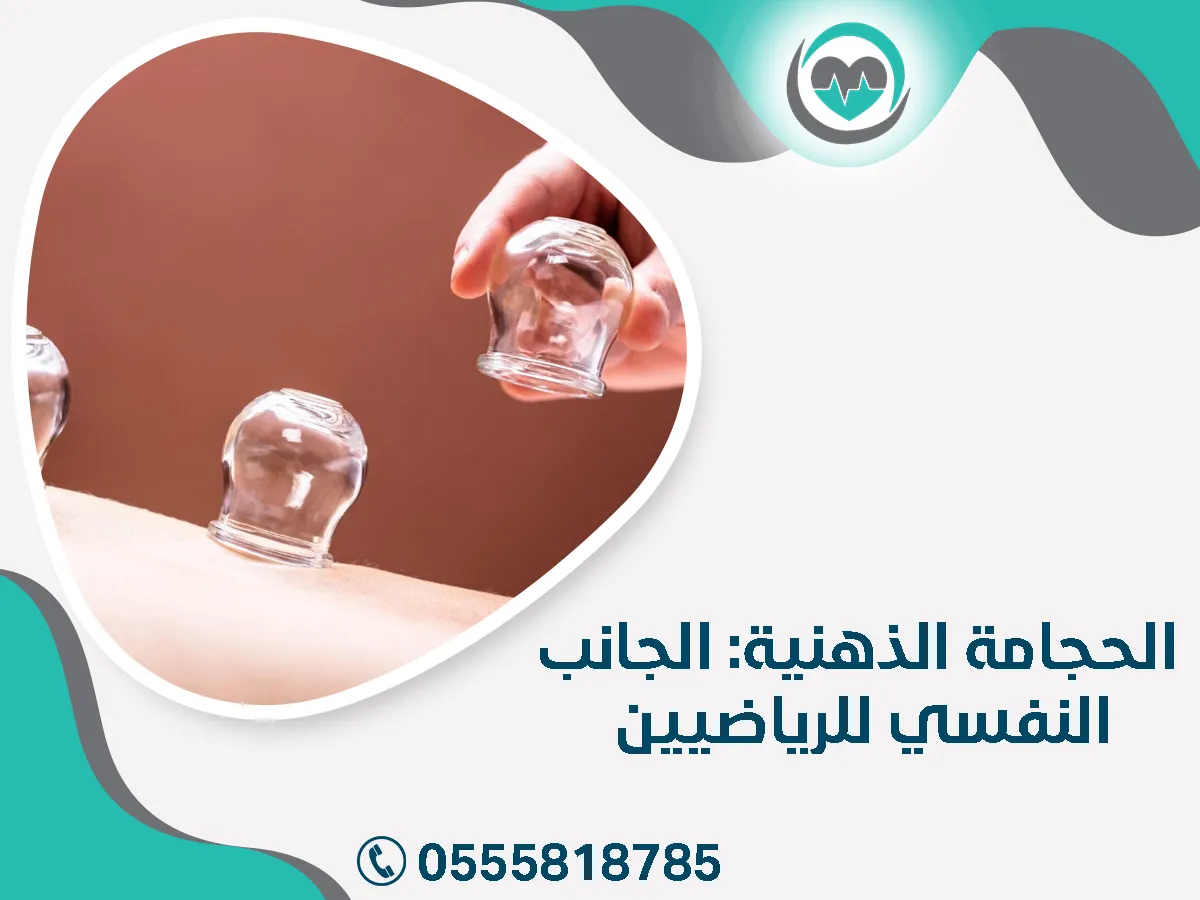 الحجامة الذهنية
