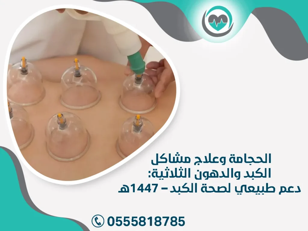 الحجامة وعلاج مشاكل الكبد والدهون الثلاثية: دعم طبيعي لصحة الكبد – 1447هـ