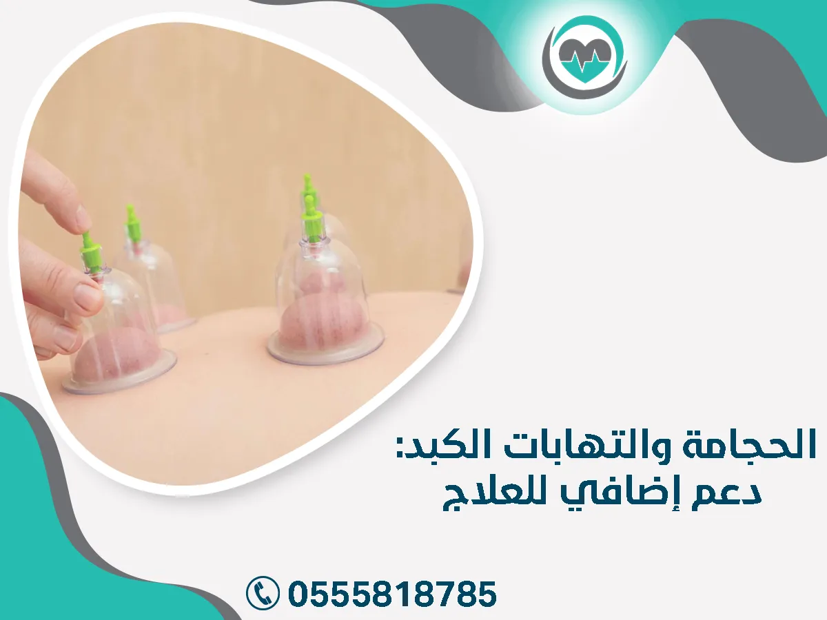 الحجامة والتهابات الكبد