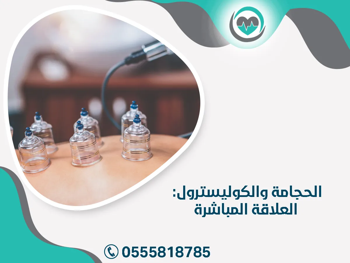 الحجامة والكوليسترول