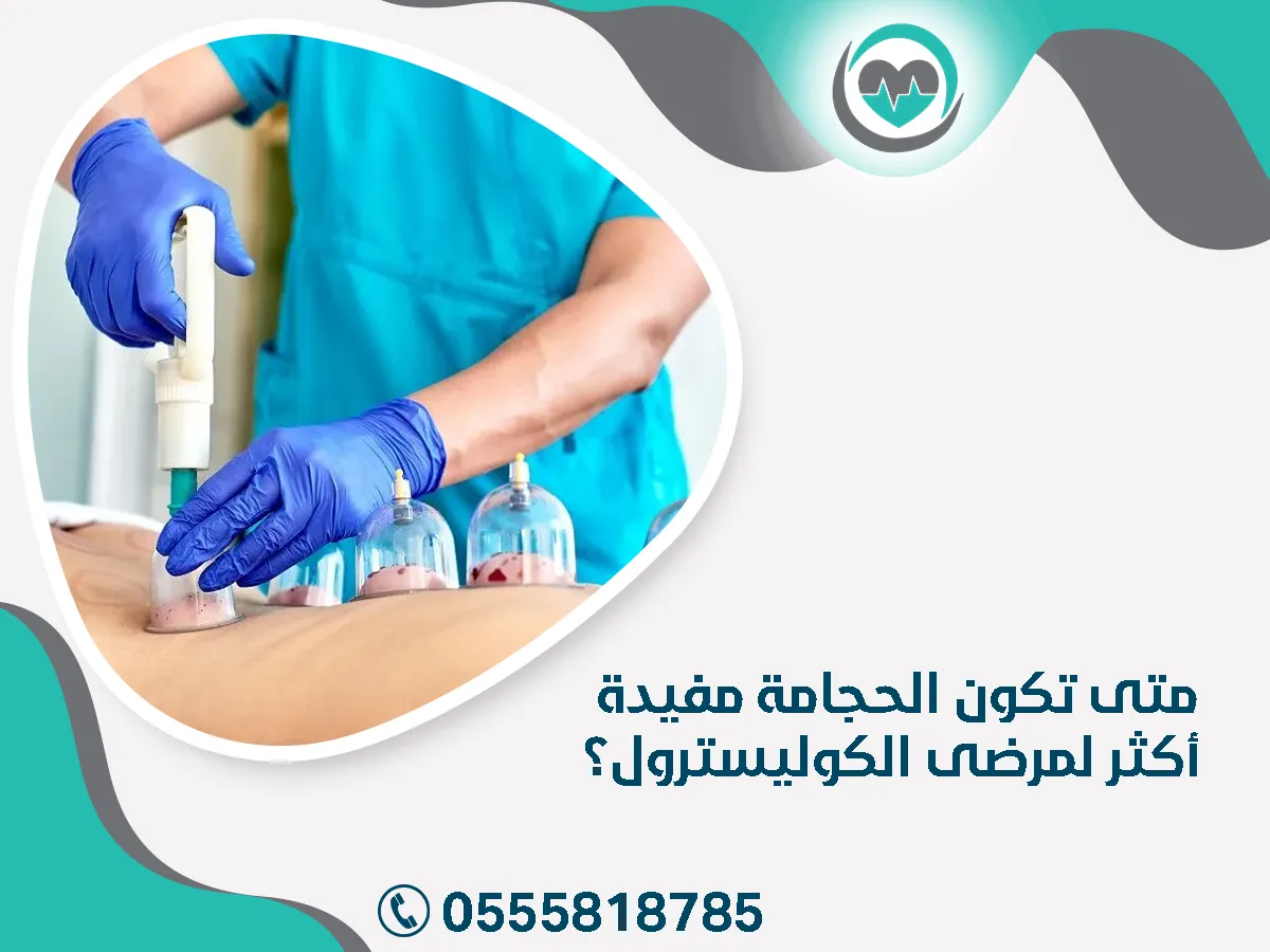 الحجامة مفيدة أكثر لمرضى الكوليسترول