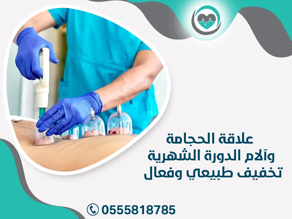 علاقة الحجامة وآلام الدورة الشهرية