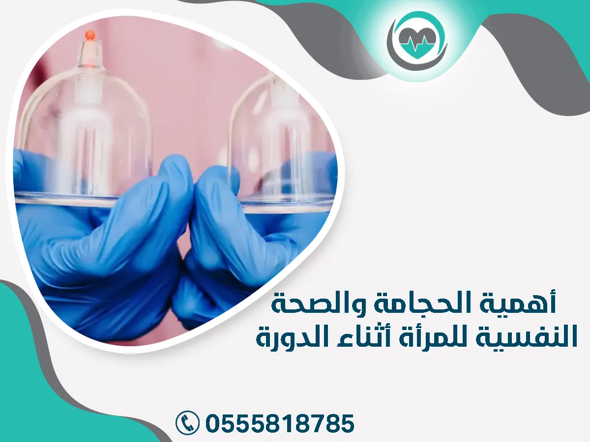 أهمية الحجامة والصحة النفسية للمرأة