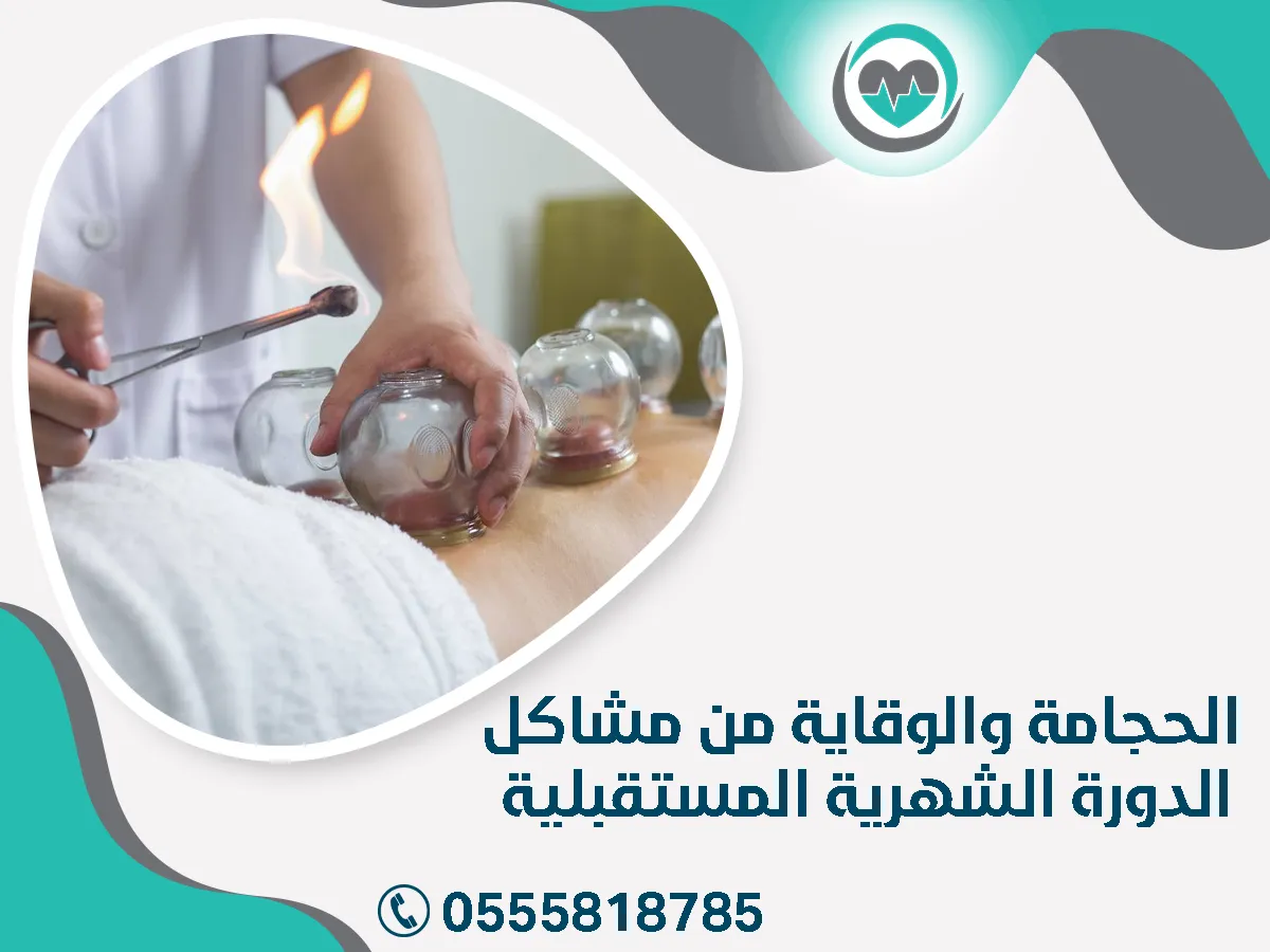 الحجامة والوقاية من مشاكل الدورة الشهرية