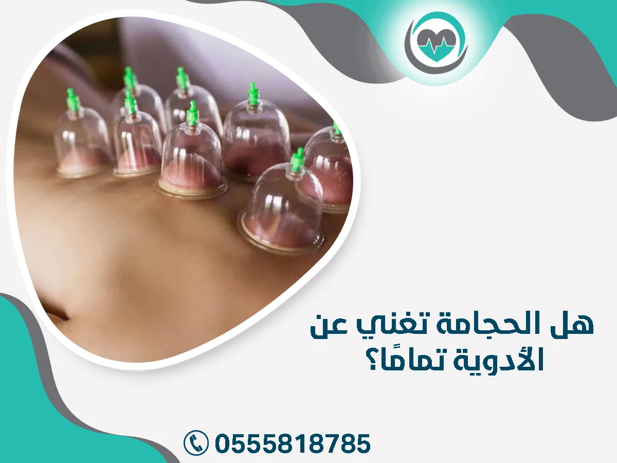 هل الحجامة تغني عن الأدوية