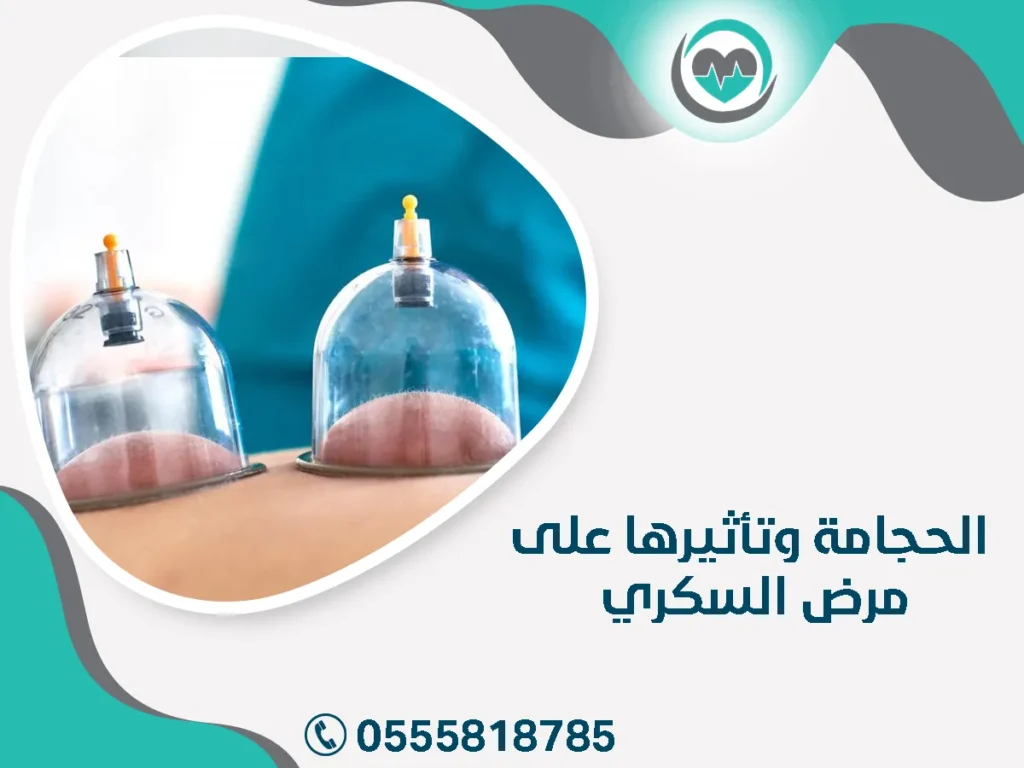 ـ الحجامة وتأثيرها على مرض السكري