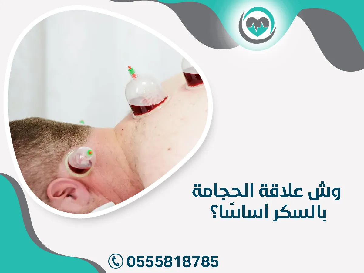 وش علاقة الحجامة بالسكر 