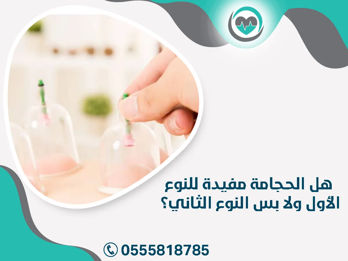 هل الحجامة مفيدة للنوع الأول 