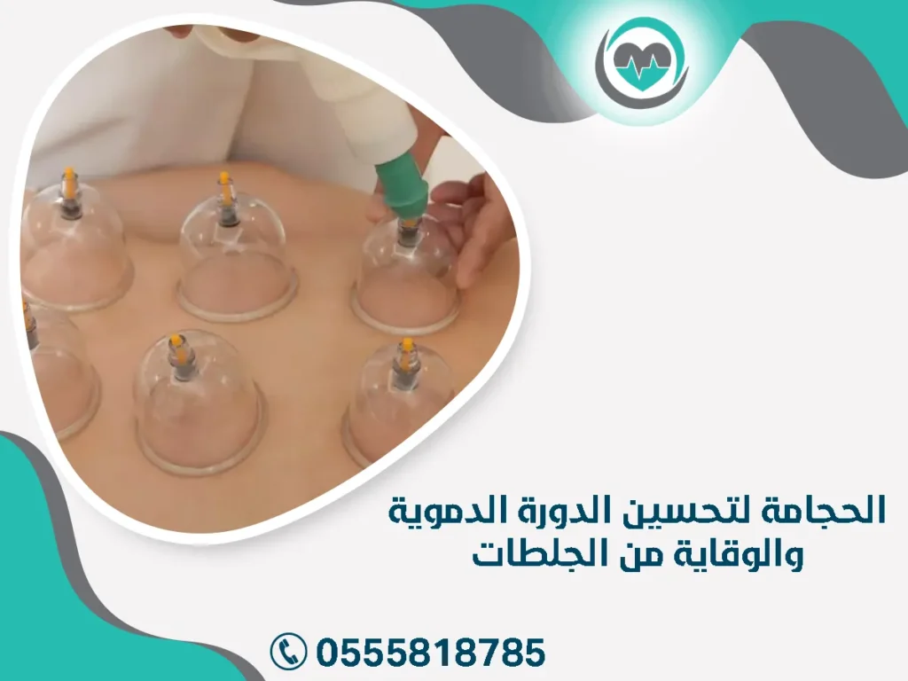 الحجامة لتحسين الدورة الدموية والوقاية من الجلطات