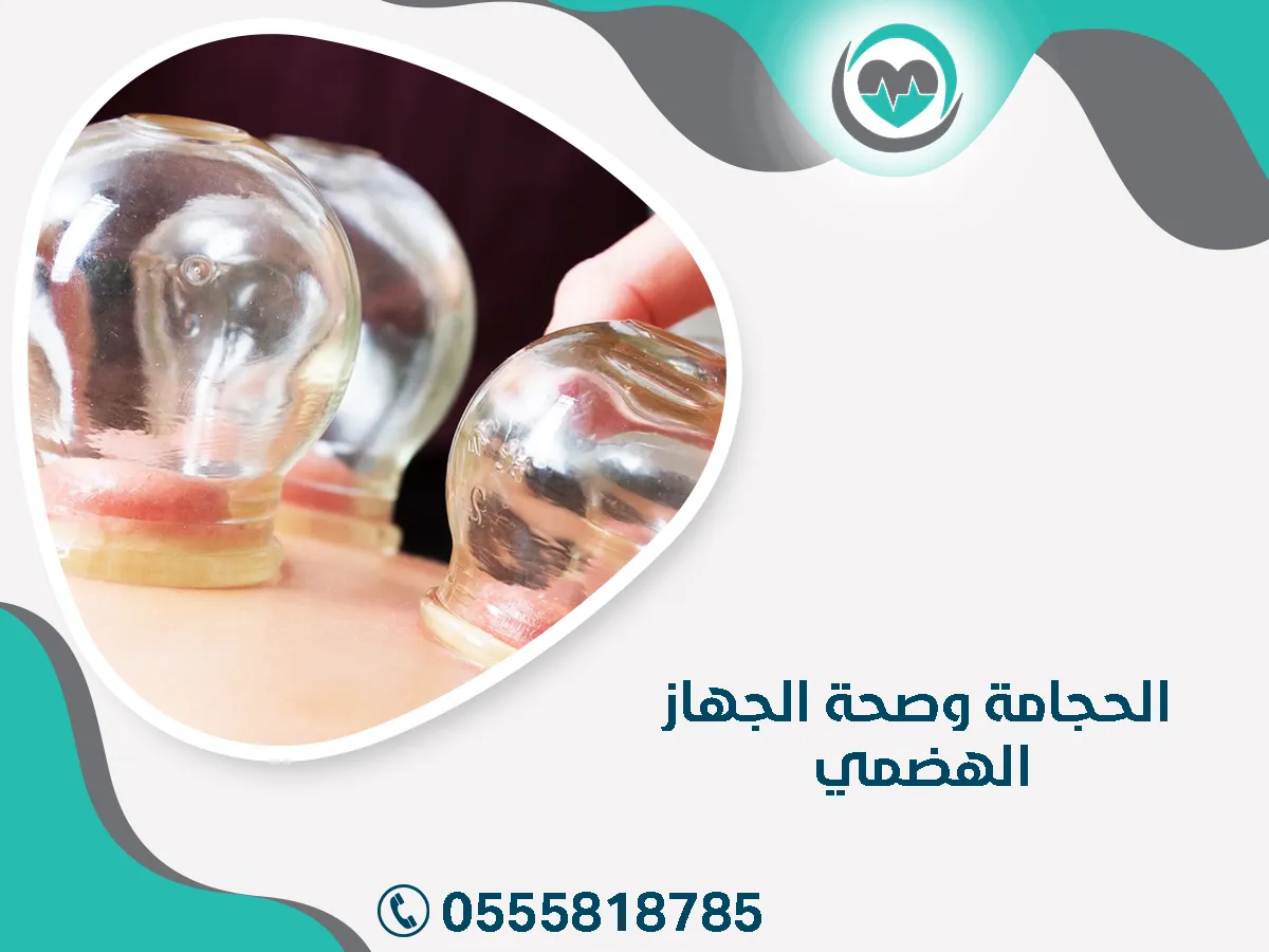 الحجامة وصحة جهاز هضمي