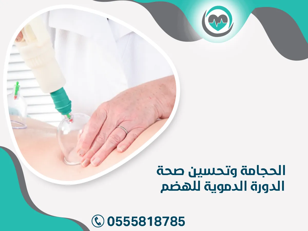 الحجامة وتحسين صحة الدورة الدموية