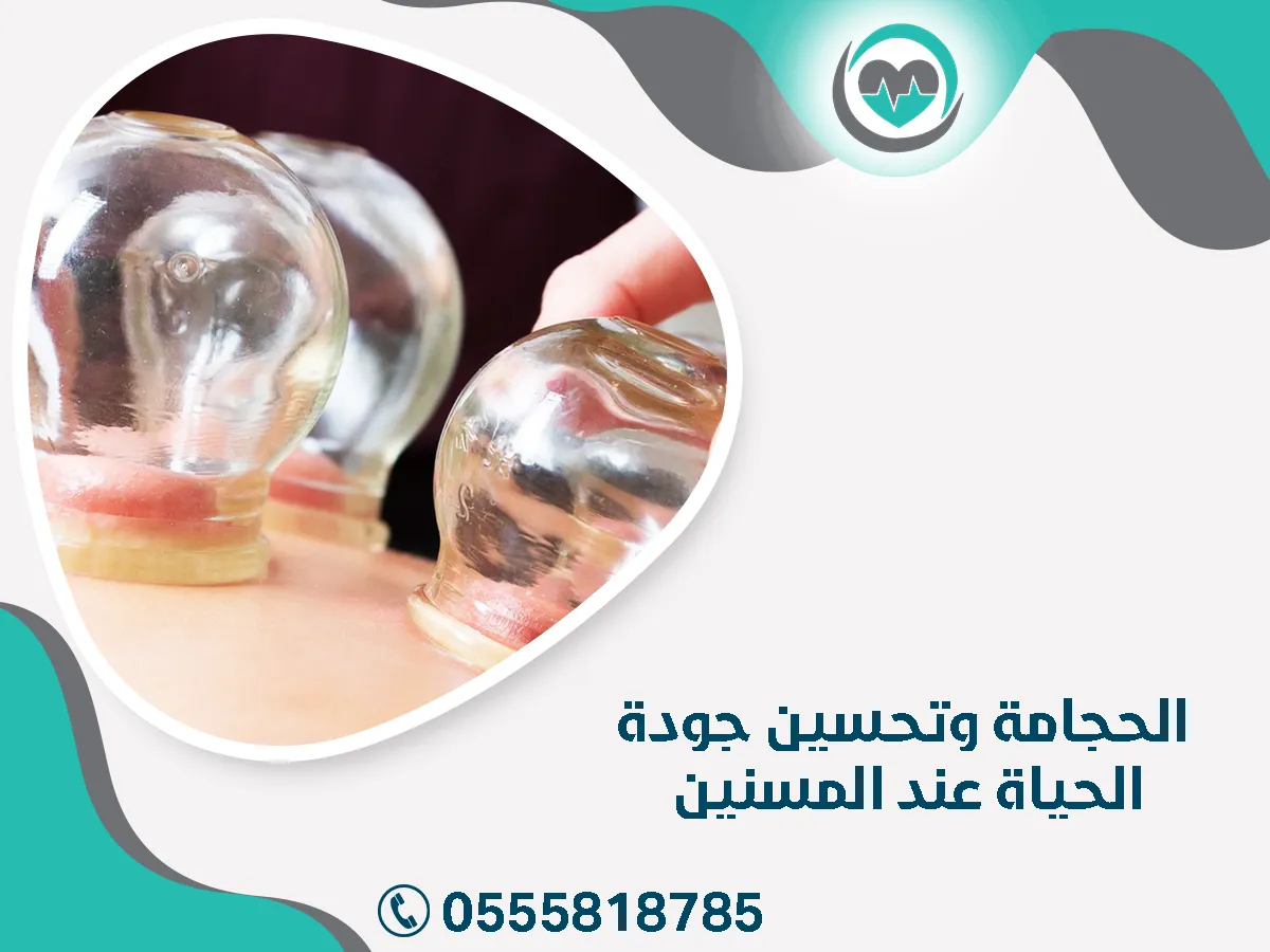 الحجامة وتحسين جودة الحياة