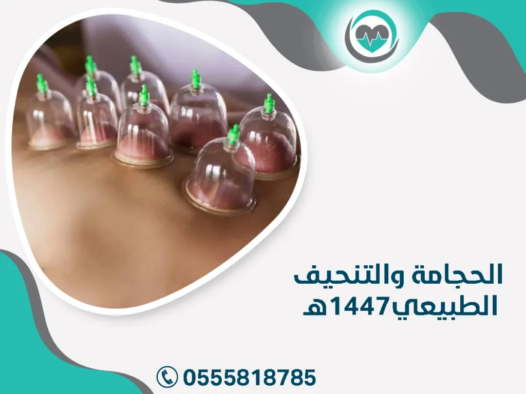 الحجامة والتنحيف الطبيعي1447هـ