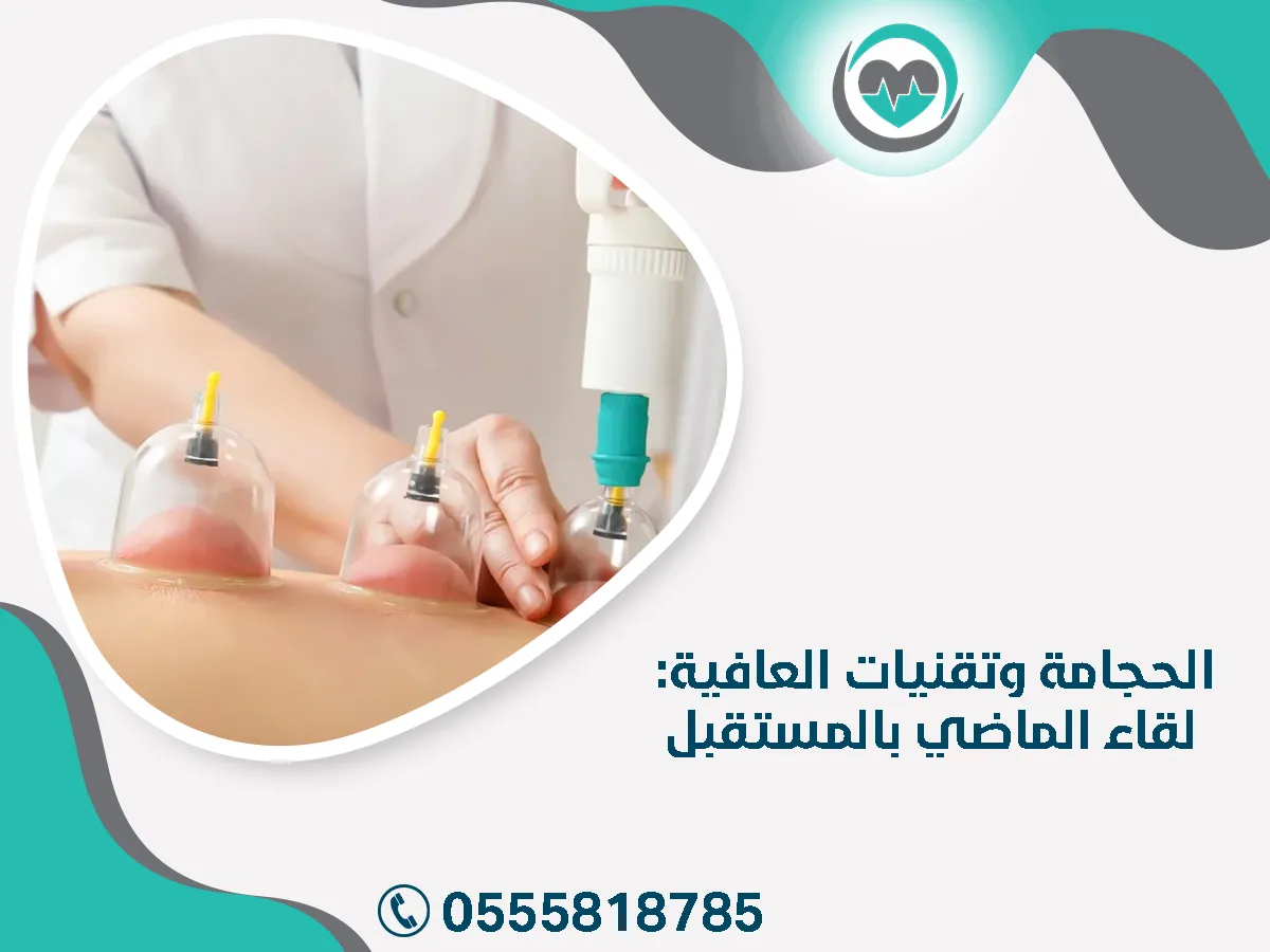 الحجامة وتقنيات العافية