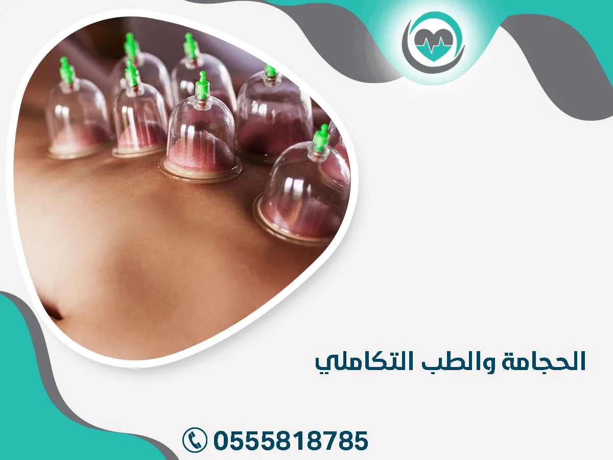 الحجامة والطب التكاملي الحديث