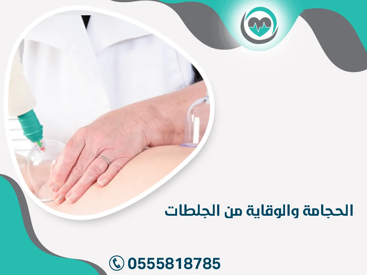 مركز خيراء الحجامة والوقاية من الجلطات
