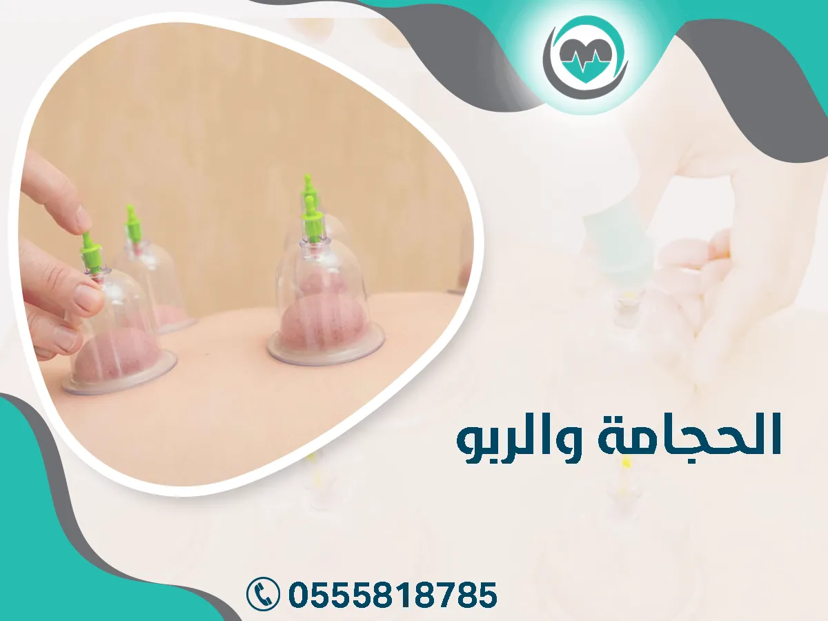 الحجامة