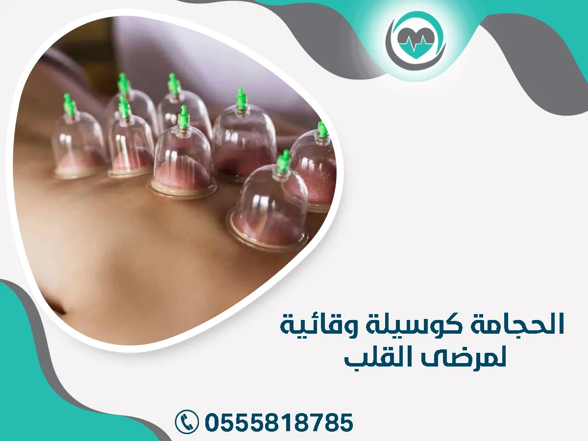 مركز خبراء الحجامة والوقاية لمرضى القلب