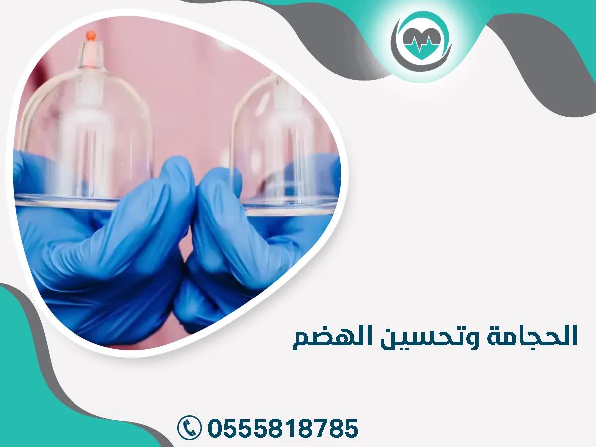 الحجامة وتحسين الهضم ـــ