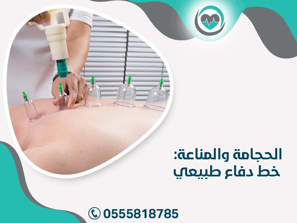 الحجامة والمناعة