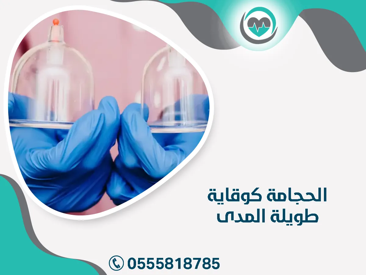 الحجامة كوقاية