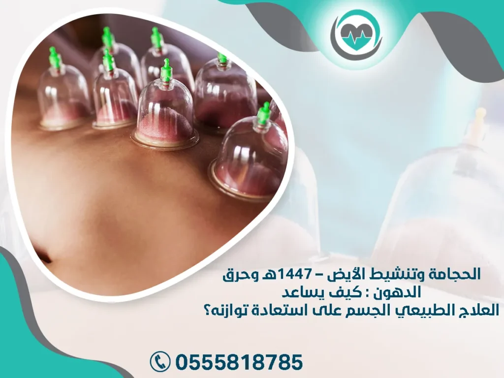 الحجامة وتنشيط الأيض – 1447هـ