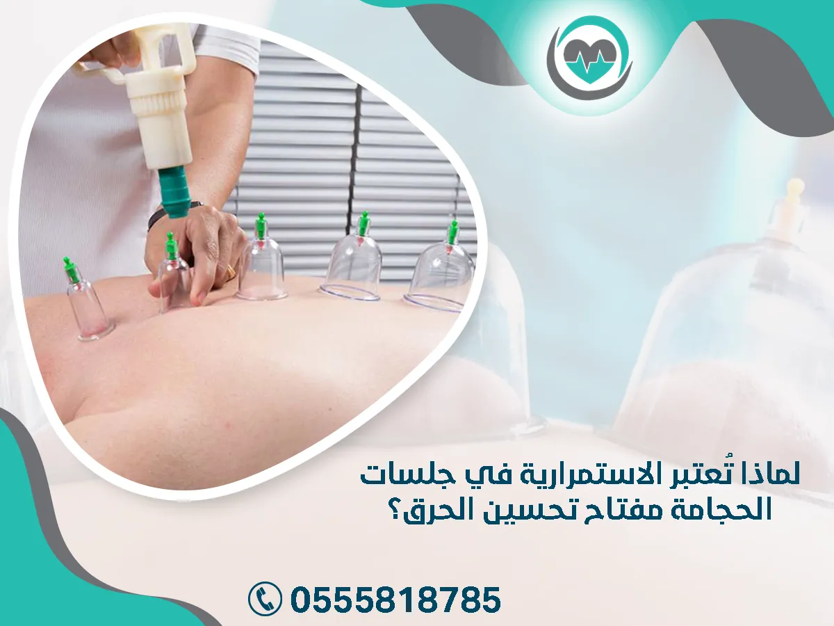 الاستمرارية في جلسات الحجامة