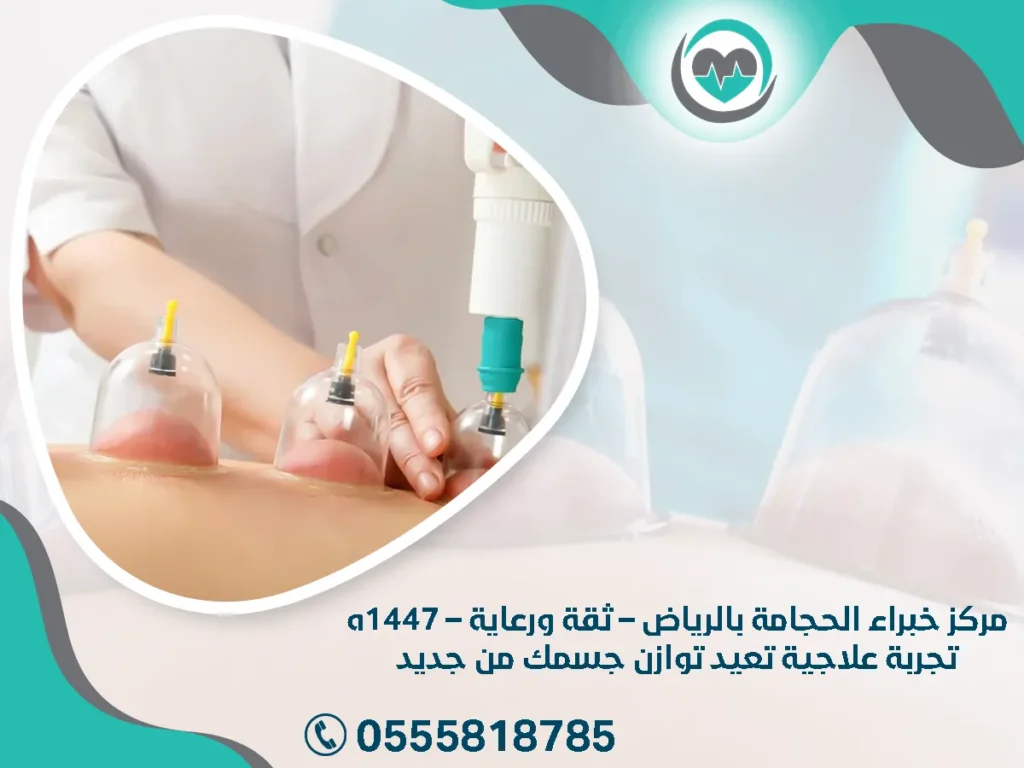 مركز خبراء الحجامة بالرياض – ثقة ورعاية – 1447هـ | تجربة علاجية تعيد توازن جسمك من جديد