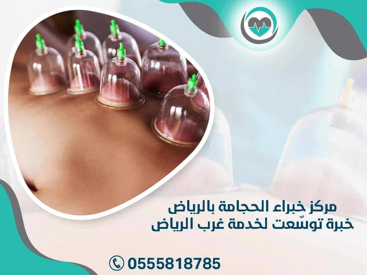 مركز خبراء الحجامة بالرياض