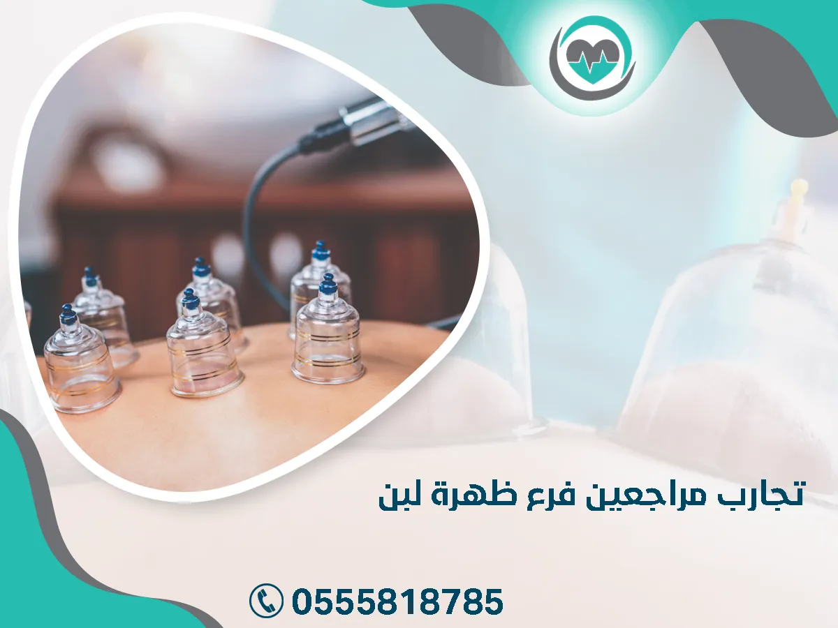 مركز خبراء الحجامة بالرياض