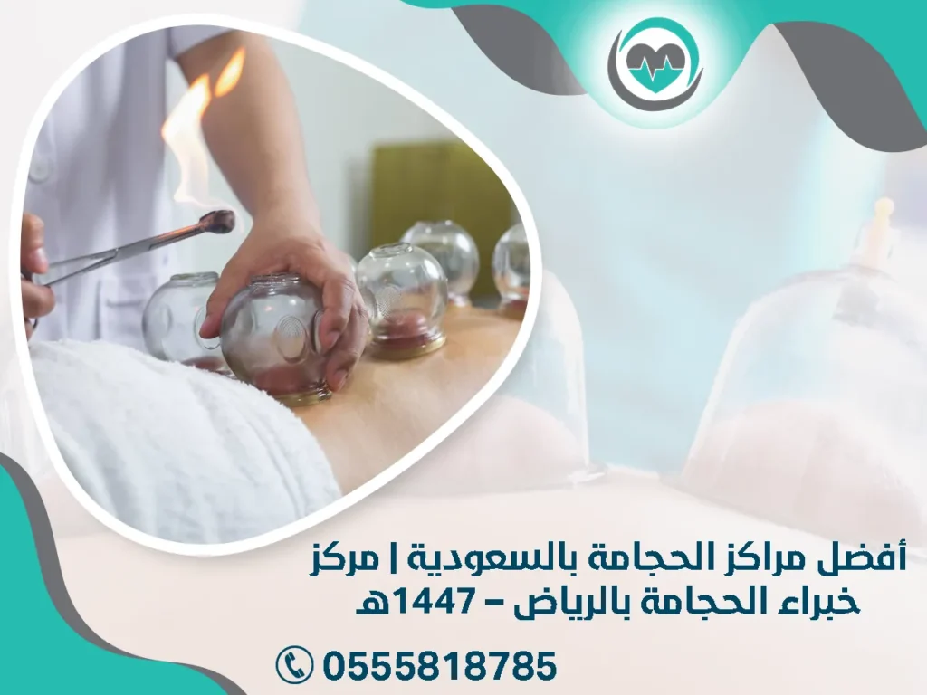 أفضل مراكز الحجامة بالسعودية