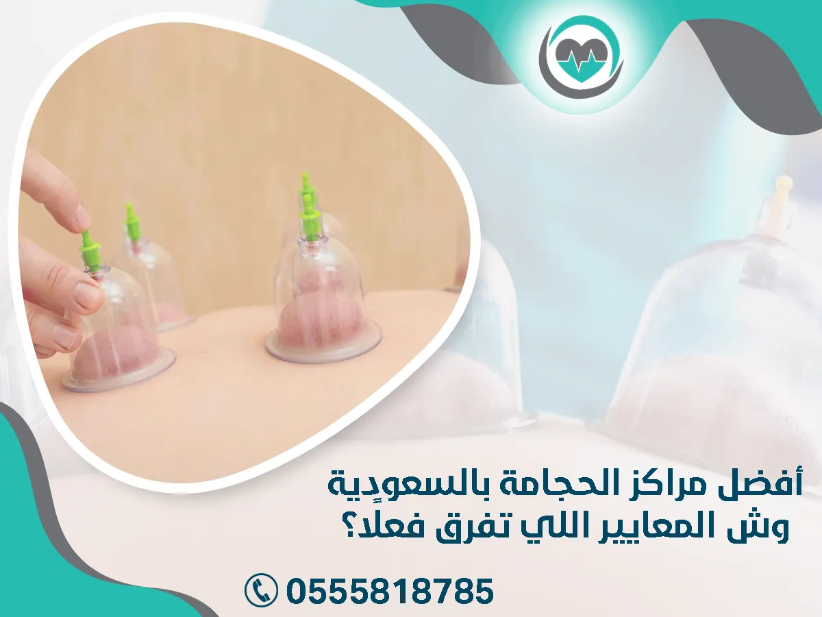 أفضل مراكز الحجامة بالسعودية… وش المعايير اللي تفرق فعلًا؟