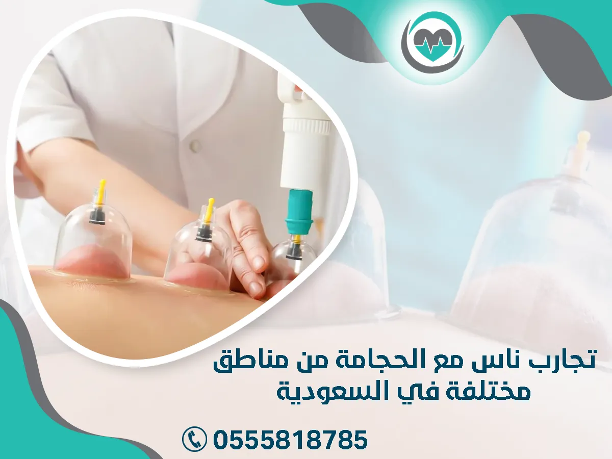 تجارب ناس مع الحجامة من مناطق مختلفة في السعودية