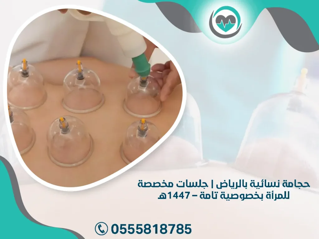 حجامة نسائية بالرياض | جلسات مخصصة للمرأة بخصوصية تامة – 1447هـ