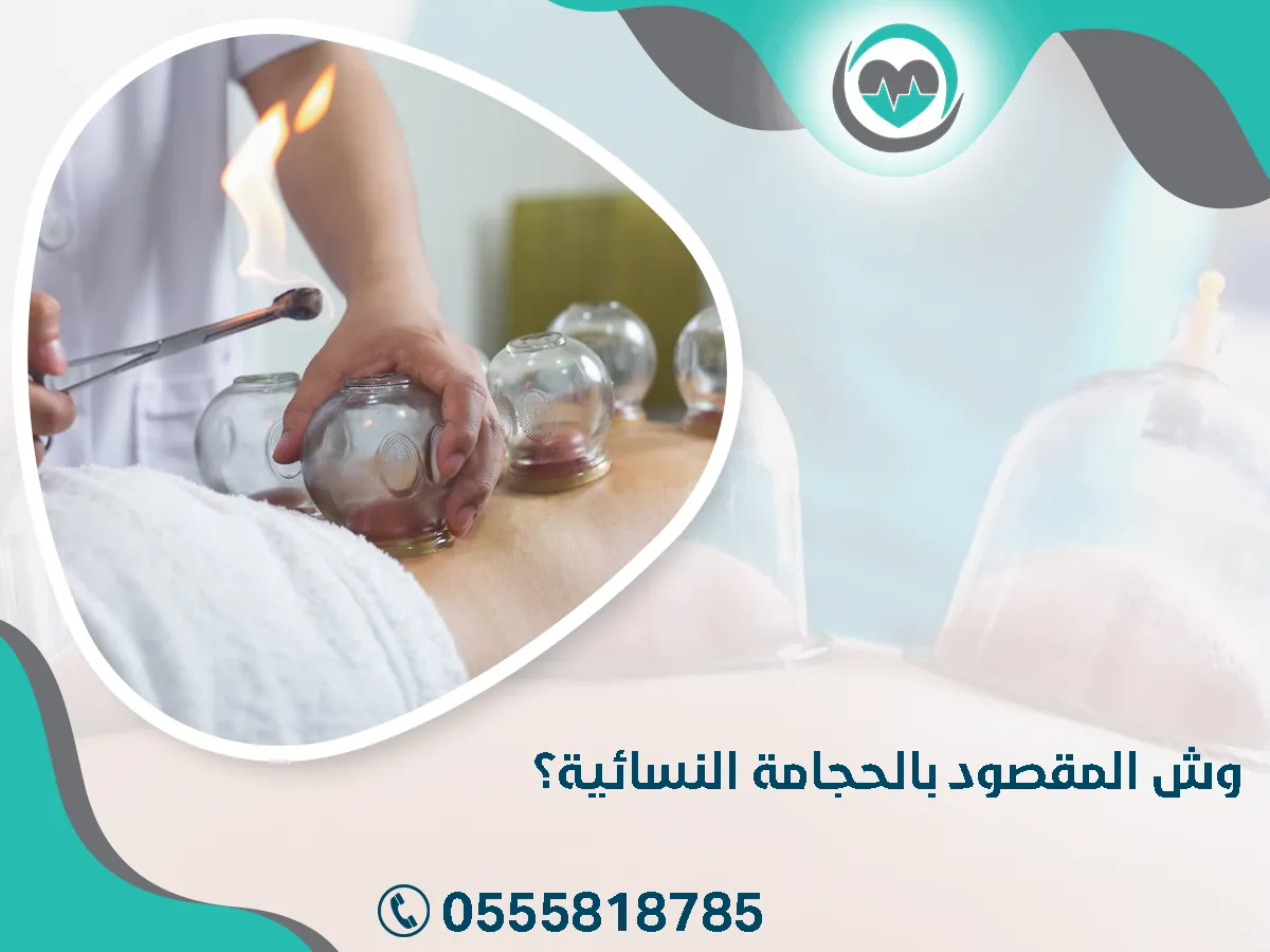 وش المقصود بالحجامة النسائية؟