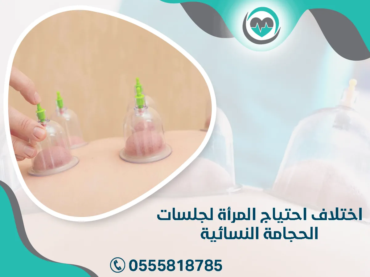 اختلاف احتياج المرأة لجلسات الحجامة