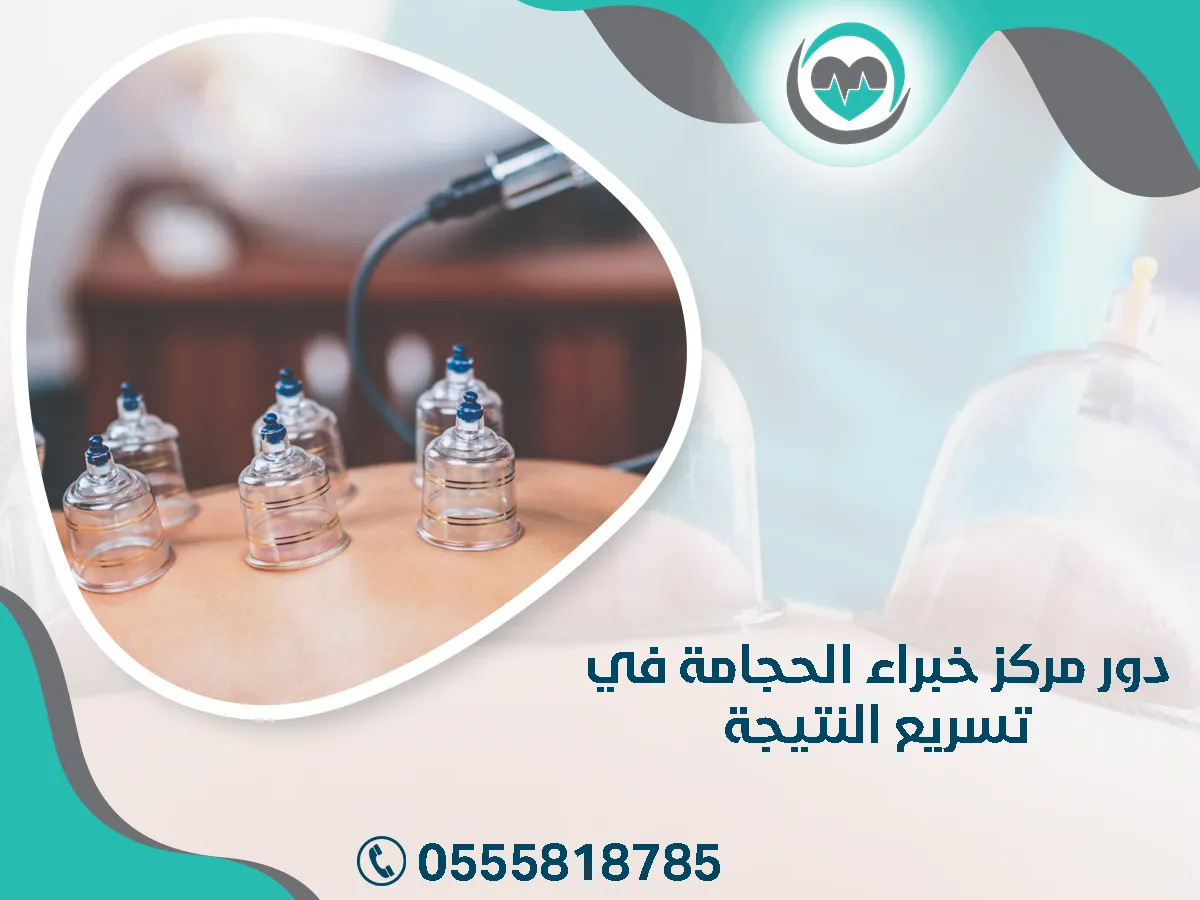 دور مركز خبراء الحجامة