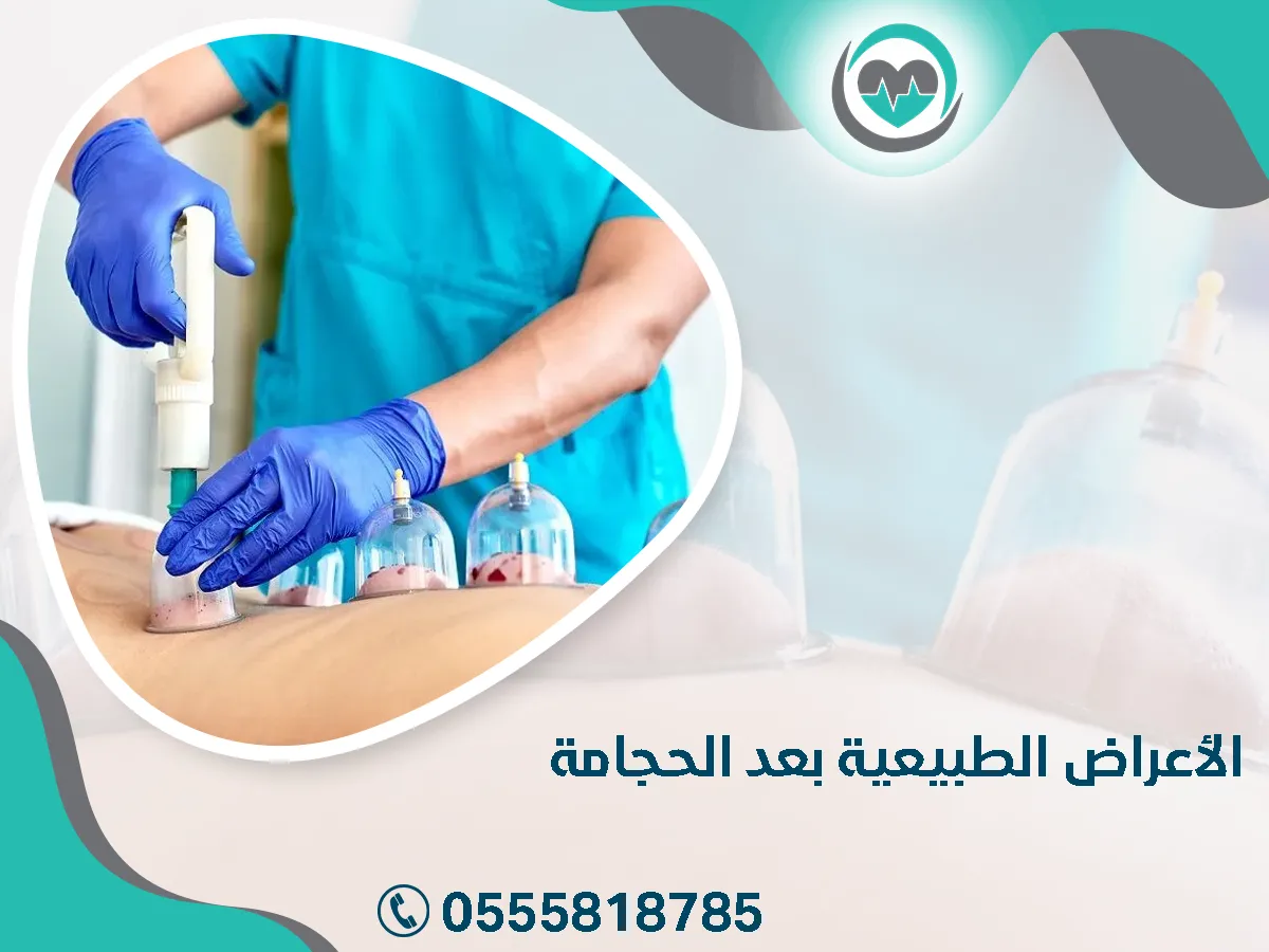 ما هي أعراض ما بعد الحجامة؟