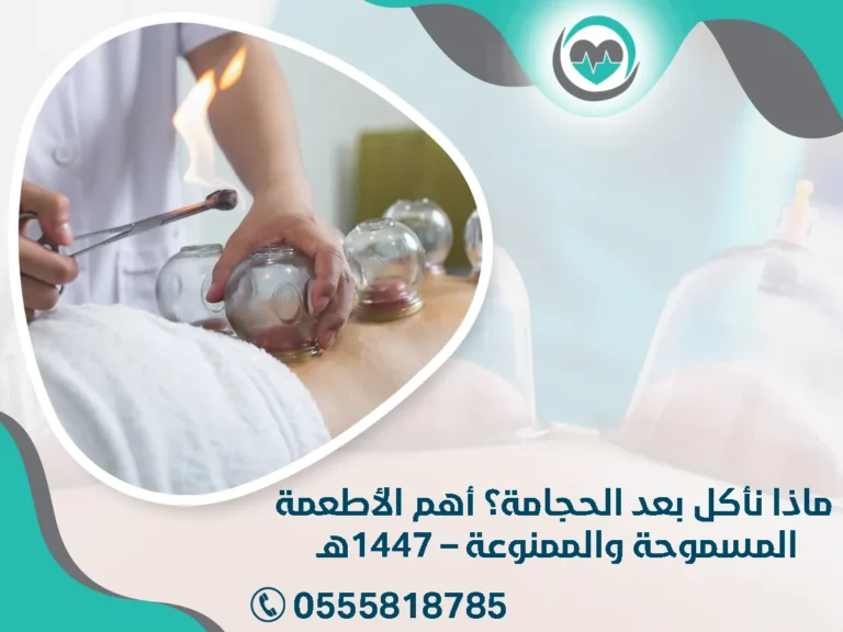 ماذا نأكل بعد الحجامة؟