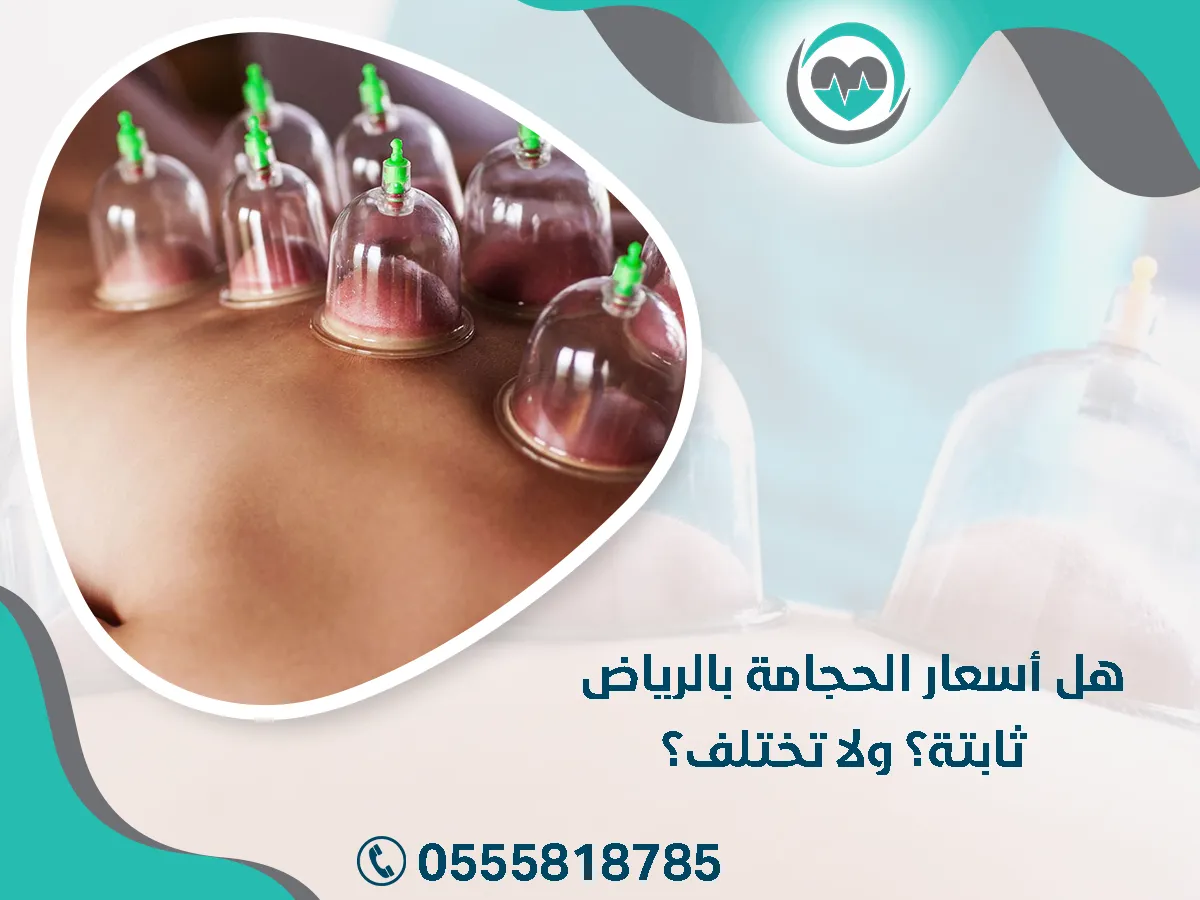 هل أسعار الحجامة بالرياض ثابتة؟ ولا تختلف؟
