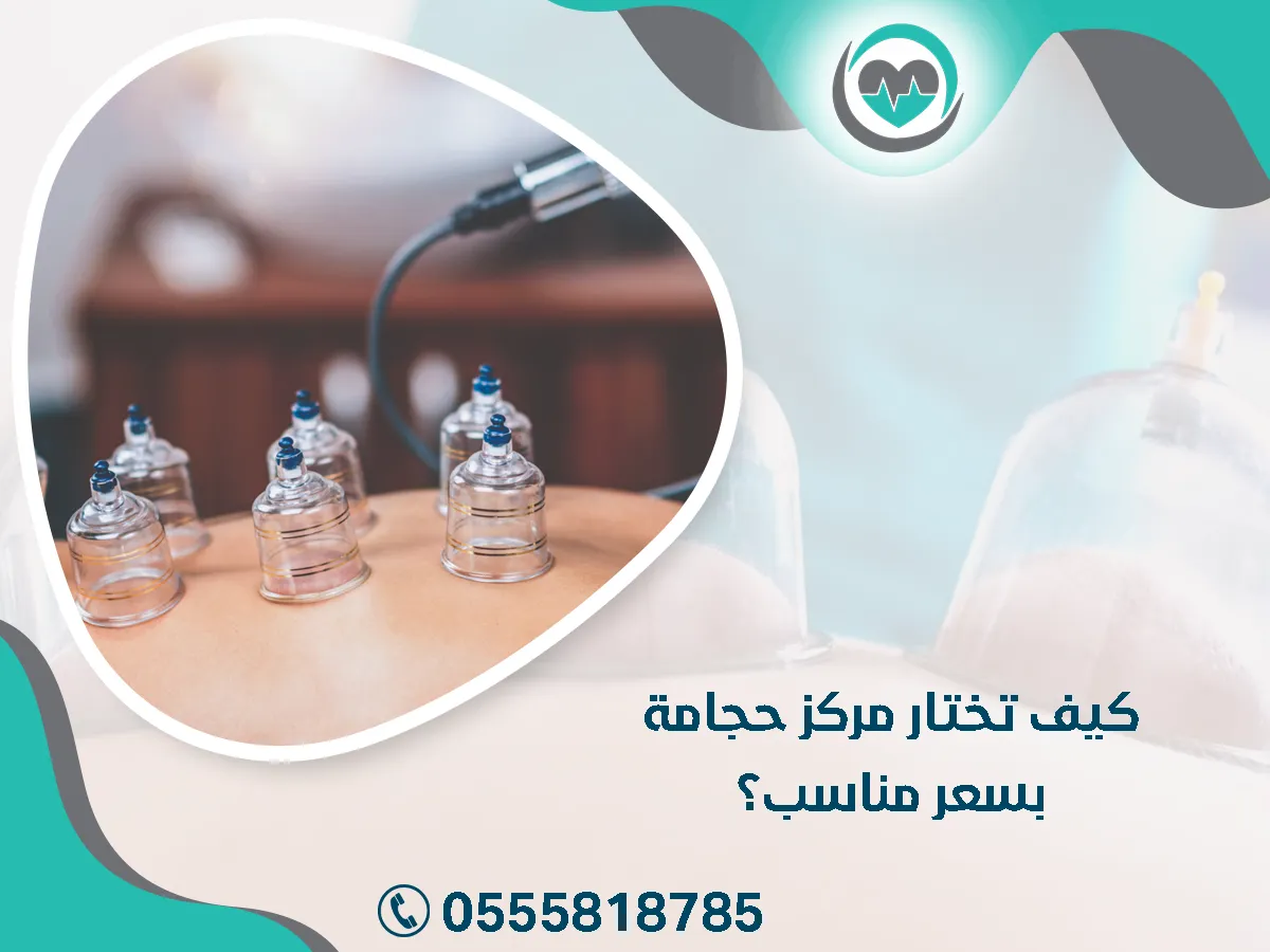 كيف تختار مركز حجامة بسعر مناسب؟