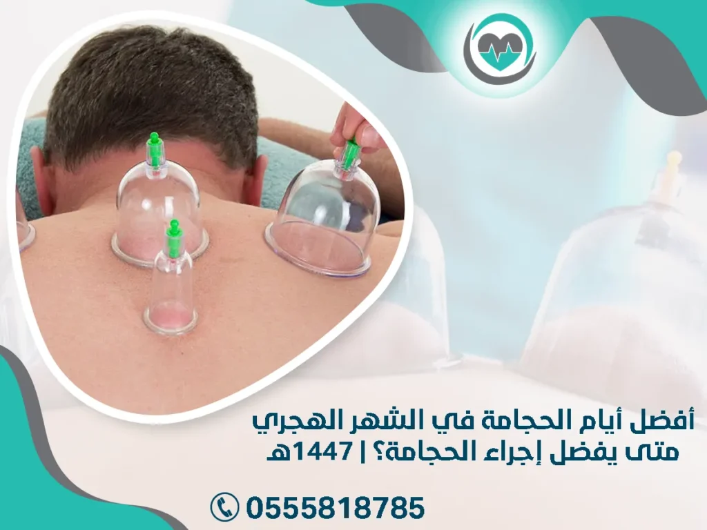 أفضل أيام الحجامة في الشهر الهجري