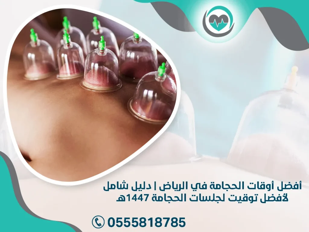 أفضل أيام الحجامة في الشهر الهجري – متى يفضل إجراء الحجامة؟ | 1447هـ