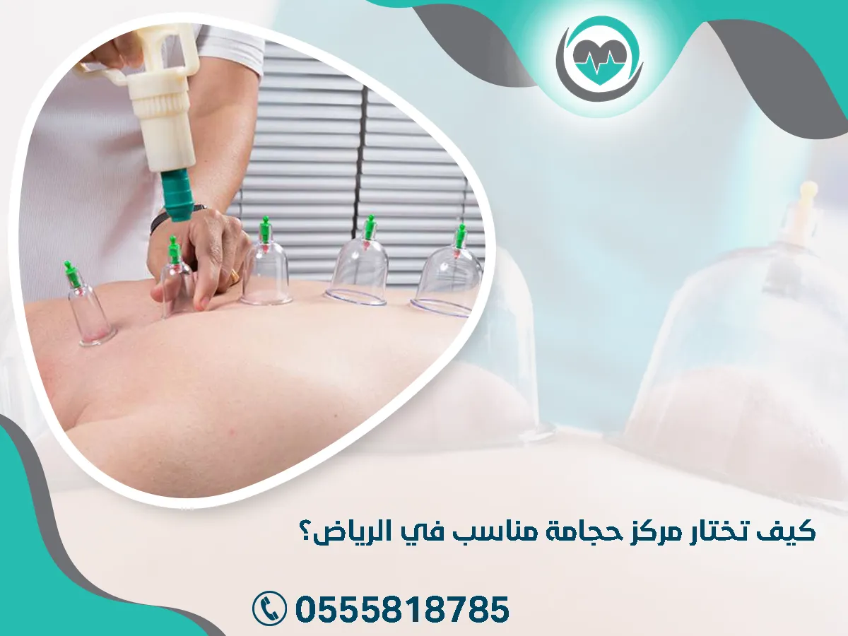 أختار مركز حجامة مناسب في الرياض