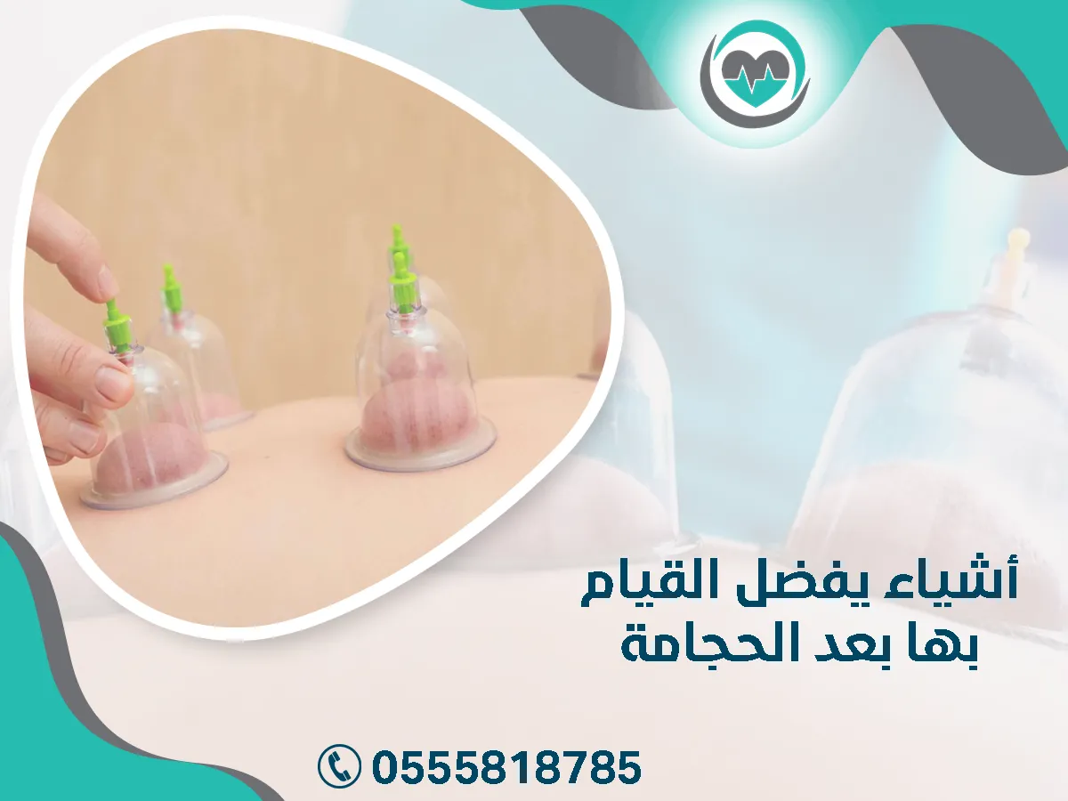 أشياء يفضل القيام بها بعد الحجامة