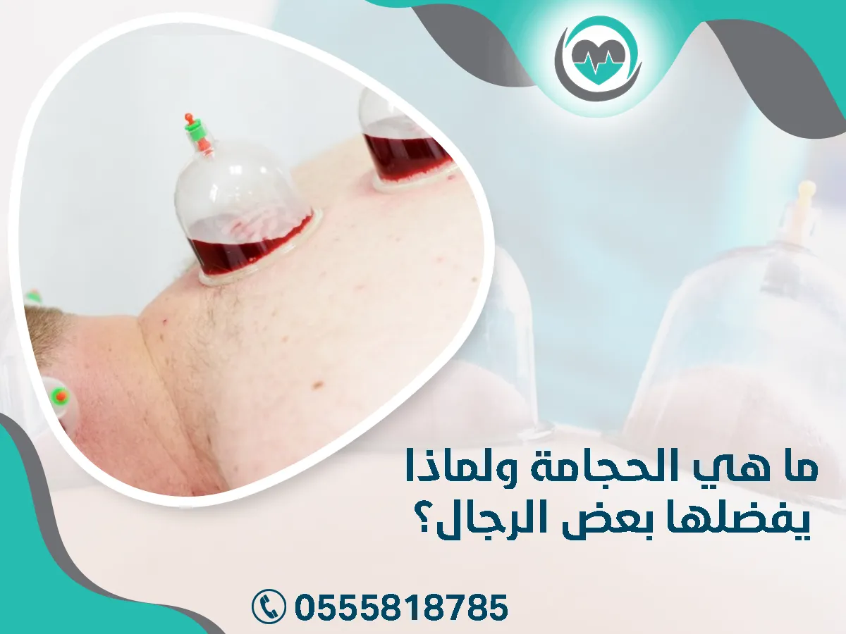 الحجامة ولماذا يفضلها بعض الرجال