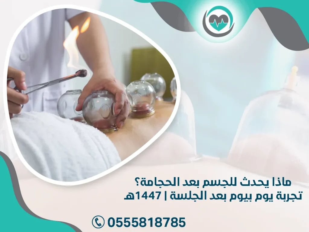 ماذا يحدث للجسم بعد الحجامة؟ تجربة يوم بيوم بعد الجلسة | 1447هـ
