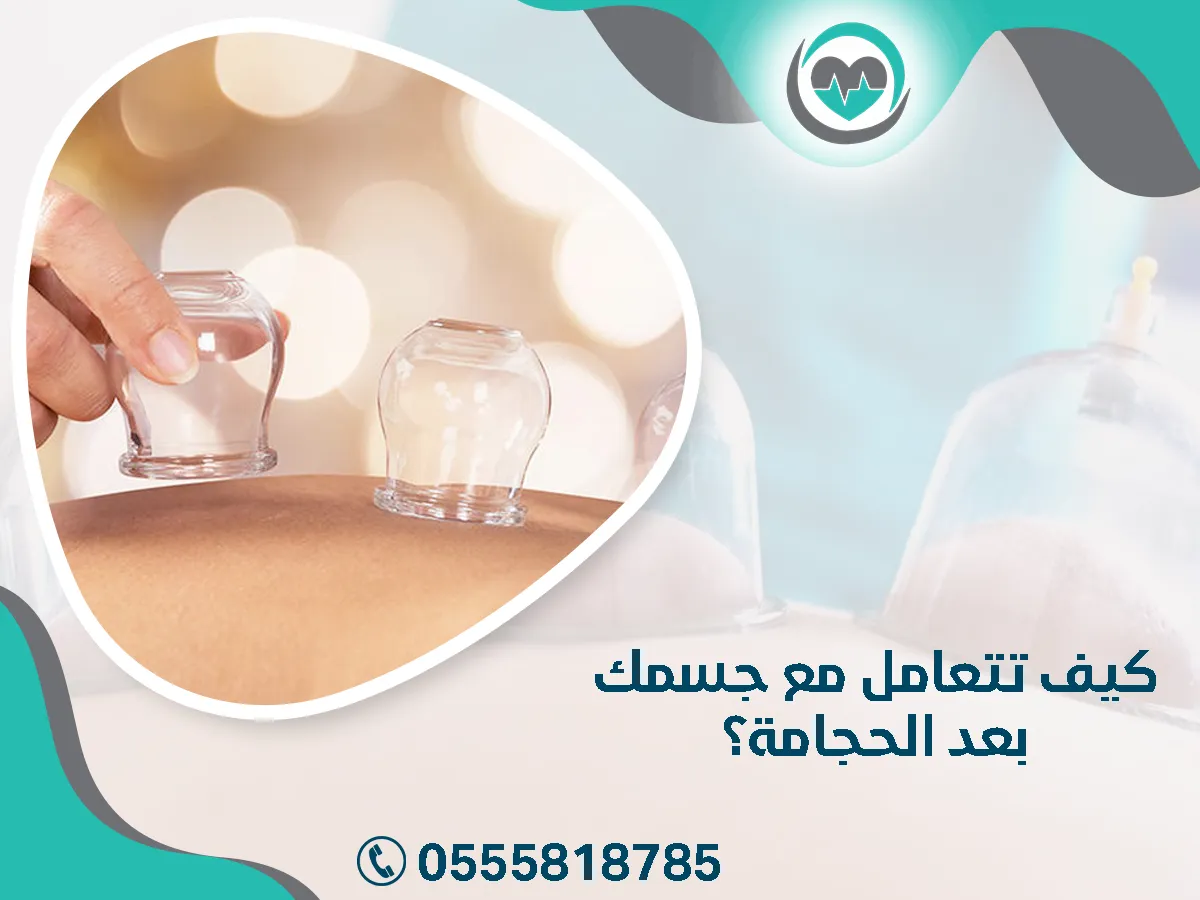 طريقه تعاملك مع جسمك بعد الحجامة